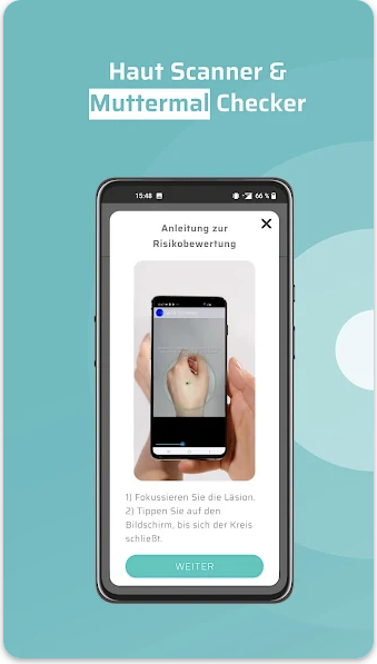 SkinScreener skin scanner