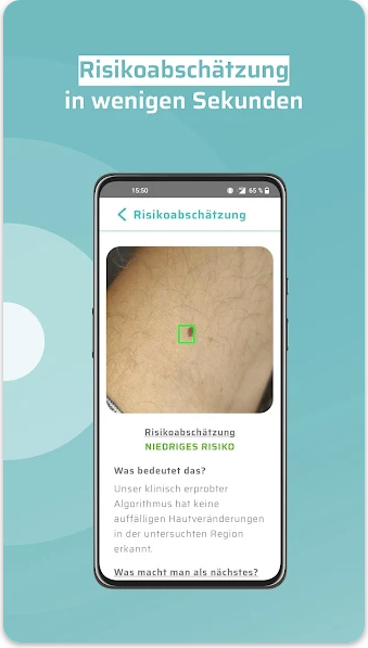 SkinScreener risk assessment